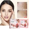 EELHOE Verruca Rose Essential Oil Soap Body Cleaning Nevus Verruca Face And Neck Silk Verruca Essence Soap