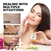 EELHOE Brightening Exfoliating Pads, Gentle Exfoliation Shrinks Pores And Brightens Natural Shine With Elasticity
