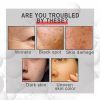 EELHOE Face Fine Line Whitening Cream, Firming Skin Repairing And Smoothing Fine Lines Delicate Pores Cream