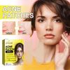 Jaysuing Acne Hydrocolloid Patch For Cleansing Facial Acne, Closing Mouth And Removing Blackheads Delicate Skin Patch
