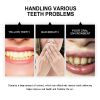 Oralhoe Teeth Whitening Powder, Teeth whitening beauty teeth cleaning tartar teeth yellow smoke teeth care for the mouth