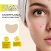 Jaysuing Acne Hydrocolloid Patch For Cleansing Facial Acne, Closing Mouth And Removing Blackheads Delicate Skin Patch
