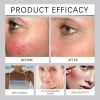 OUHOE Hyaluronic Acid Skin Care, Outdoor Uv Protection Multi-Functional Isolation Skin Gentle Moisturizing Protective Cream